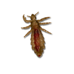 Head Lice Image